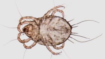 mite photo up close to show legs and body