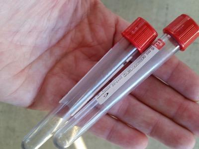 test tubes for blood draw
